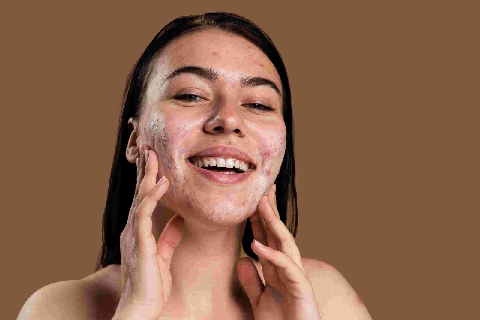 Best anti-pimple cream for oily skin