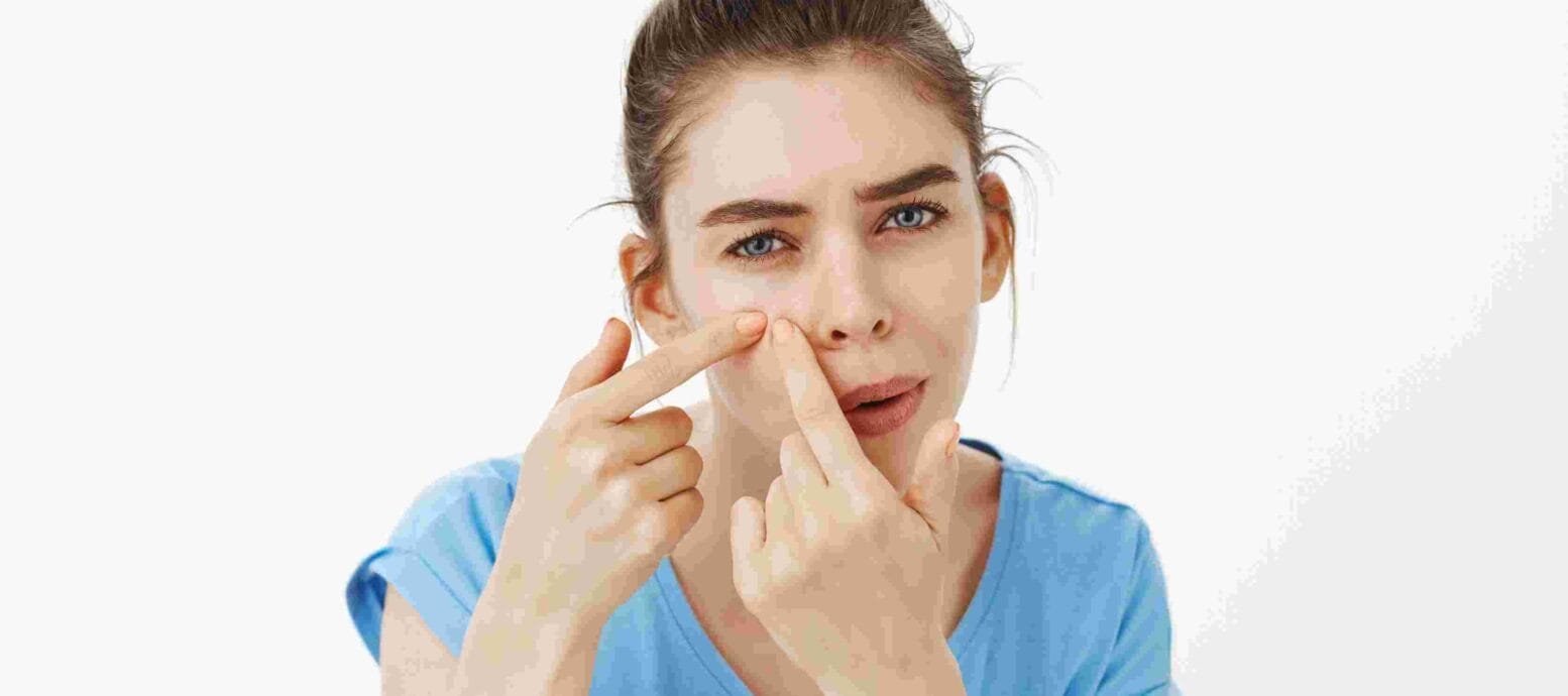 acne removal cream for oily skin