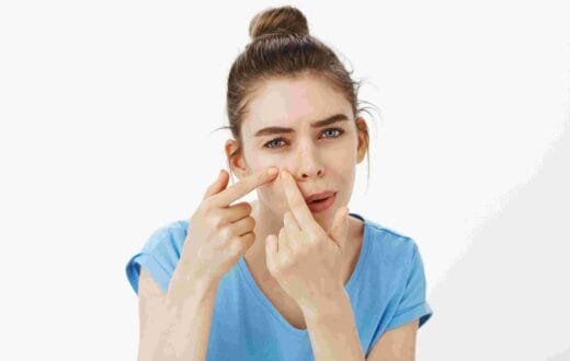 acne removal cream for oily skin